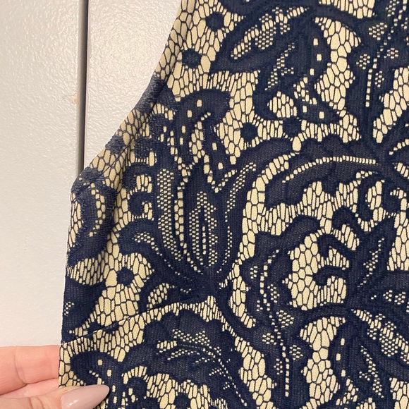 ASOS lace dress - Picture 2 of 3